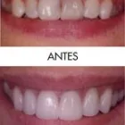 La imagen 2 de la Empresa CENTRO DE ESPECIALIDADES ODONTOLOGICAS 23 DE ENERO C.A Prótesis en Maracay D