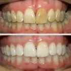 La imagen 3 de la Empresa CENTRO DE ESPECIALIDADES ODONTOLOGICAS 23 DE ENERO C.A Prótesis en Maracay D