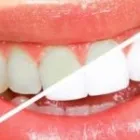 La imagen 4 de la Empresa CENTRO DE ESPECIALIDADES ODONTOLOGICAS 23 DE ENERO C.A Prótesis en Maracay D