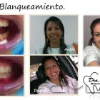 La imagen 4 de la Empresa CONSULTORIO ODONTOLOGICO DRA NARELIS LORETO Salud Caracas en Caracas M