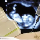 La imagen 5 de la Empresa DIAGNOGEN - DR. HUMBERTO MORENO Prueba de Paternidad por Adn en Maracaibo V