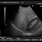 La imagen 1 de la Empresa DR JOEL PANTOJA GAERSTE ULTRASONIDO MÉDICO en Valencia G