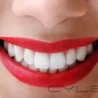 La imagen 2 de la Empresa DRA. LEONELLA CERMEÑO Tratamientos de Conducto en Caracas M