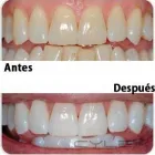 La imagen 3 de la Empresa DRA. LEONELLA CERMEÑO Tratamientos de Conducto en Caracas M