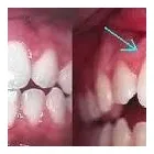 La imagen 2 de la Empresa DRA. ZURIMA RUSSIAN Restauraciones Estéticas en Maturín N