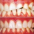 La imagen 6 de la Empresa DRA. ZURIMA RUSSIAN Restauraciones Estéticas en Maturín N