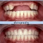 La imagen 7 de la Empresa DRA. ZURIMA RUSSIAN Restauraciones Estéticas en Maturín N