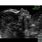 La imagen 1 de la Empresa PATRICIA ARIAS Ginecologia y Obstetricia en Maracay D