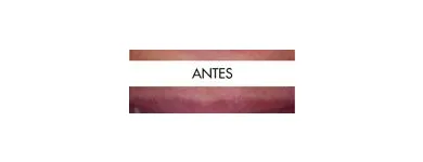 La imagen 2 de la Empresa CENTRO DE ESPECIALIDADES ODONTOLOGICAS 23 DE ENERO C.A Prótesis en Maracay D