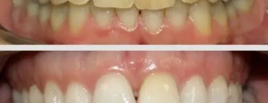 La imagen 3 de la Empresa CENTRO DE ESPECIALIDADES ODONTOLOGICAS 23 DE ENERO C.A Prótesis en Maracay D