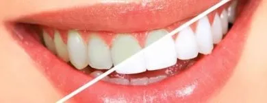 La imagen 4 de la Empresa CENTRO DE ESPECIALIDADES ODONTOLOGICAS 23 DE ENERO C.A Prótesis en Maracay D