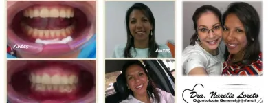 La imagen 4 de la Empresa CONSULTORIO ODONTOLOGICO DRA NARELIS LORETO Salud Caracas en Caracas M