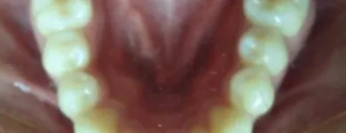 La imagen 1 de la Empresa DR. EDUARDO J. APONTE R. / ORTODONCISTA Salud en Caracas M