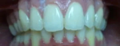 La imagen 3 de la Empresa DR. EDUARDO J. APONTE R. / ORTODONCISTA Salud en Caracas M