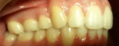 La imagen 4 de la Empresa DR. EDUARDO J. APONTE R. / ORTODONCISTA Salud en Caracas M