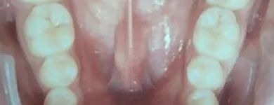 La imagen 6 de la Empresa DR. EDUARDO J. APONTE R. / ORTODONCISTA Salud en Caracas M