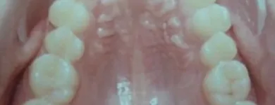 La imagen 7 de la Empresa DR. EDUARDO J. APONTE R. / ORTODONCISTA Salud en Caracas M