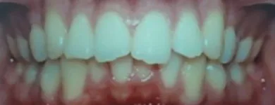 La imagen 8 de la Empresa DR. EDUARDO J. APONTE R. / ORTODONCISTA Salud en Caracas M