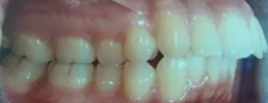 La imagen 9 de la Empresa DR. EDUARDO J. APONTE R. / ORTODONCISTA Salud en Caracas M