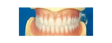 La imagen 2 de la Empresa MECANICA DENTAL Prótesis en Valencia G