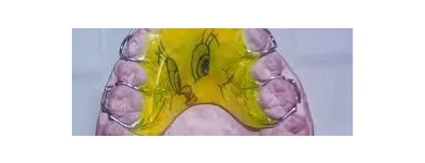 La imagen 8 de la Empresa MECANICA DENTAL Prótesis en Valencia G