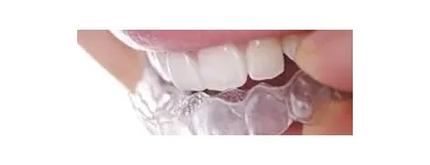 La imagen 14 de la Empresa MECANICA DENTAL Prótesis en Valencia G