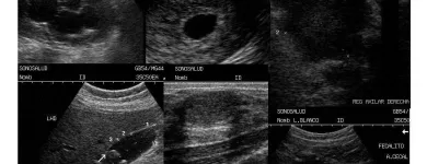 La imagen 1 de la Empresa SONOSALUD 2012, C.A. Salud en Caracas M