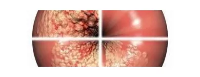 La imagen 3 de la Empresa SONOSALUD 2012, C.A. Salud en Caracas M