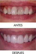 La imagen 2 de la Empresa CENTRO DE ESPECIALIDADES ODONTOLOGICAS 23 DE ENERO C.A