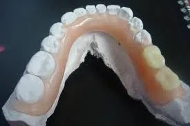 La imagen 1 de la Empresa MECANICA DENTAL