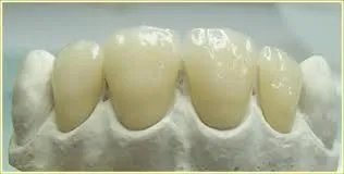 La imagen 5 de la Empresa MECANICA DENTAL