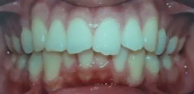 La imagen 8 de la Empresa DR. EDUARDO J. APONTE R. / ORTODONCISTA