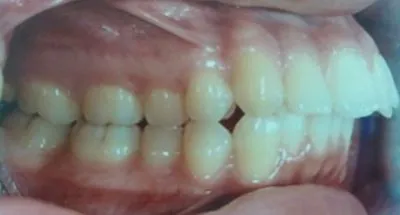 La imagen 9 de la Empresa DR. EDUARDO J. APONTE R. / ORTODONCISTA