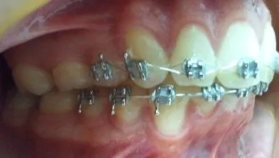 La imagen 5 de la Empresa DR. EDUARDO J. APONTE R. / ORTODONCISTA
