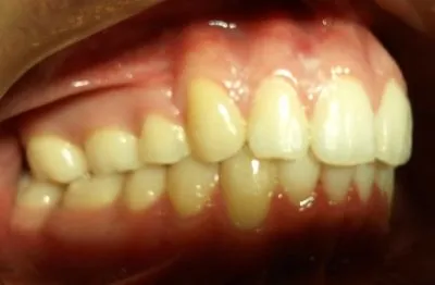 La imagen 4 de la Empresa DR. EDUARDO J. APONTE R. / ORTODONCISTA