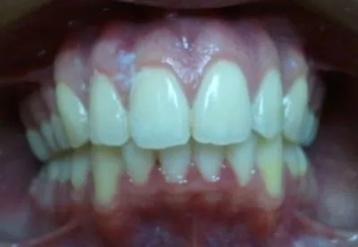 La imagen 3 de la Empresa DR. EDUARDO J. APONTE R. / ORTODONCISTA