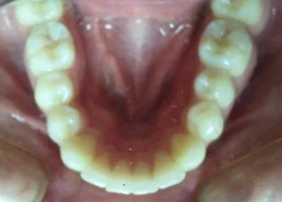 La imagen 1 de la Empresa DR. EDUARDO J. APONTE R. / ORTODONCISTA