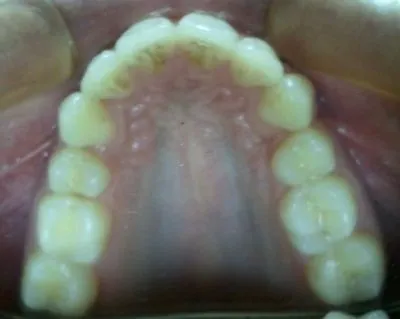 La imagen 2 de la Empresa DR. EDUARDO J. APONTE R. / ORTODONCISTA