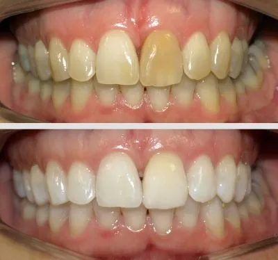 La imagen 3 de la Empresa CENTRO DE ESPECIALIDADES ODONTOLOGICAS 23 DE ENERO C.A