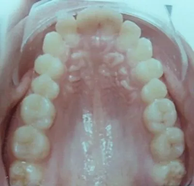 La imagen 7 de la Empresa DR. EDUARDO J. APONTE R. / ORTODONCISTA